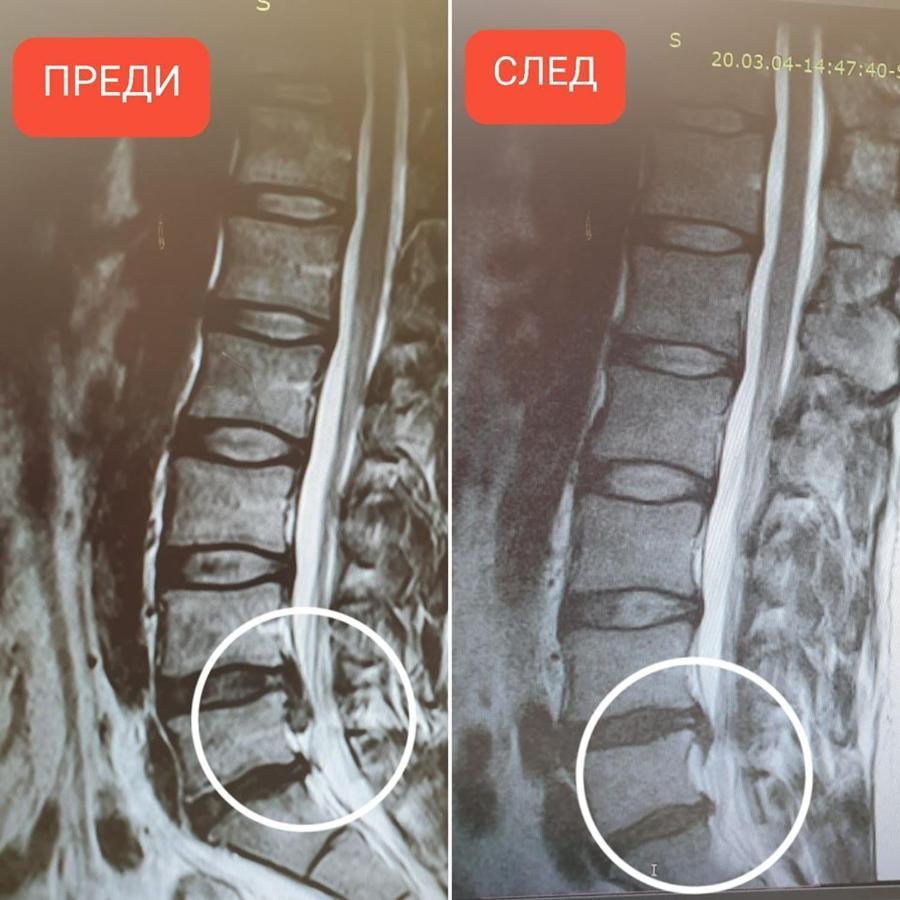 Hotel-Clinic Dr. Gechevi Pavel Banja Exteriér fotografie